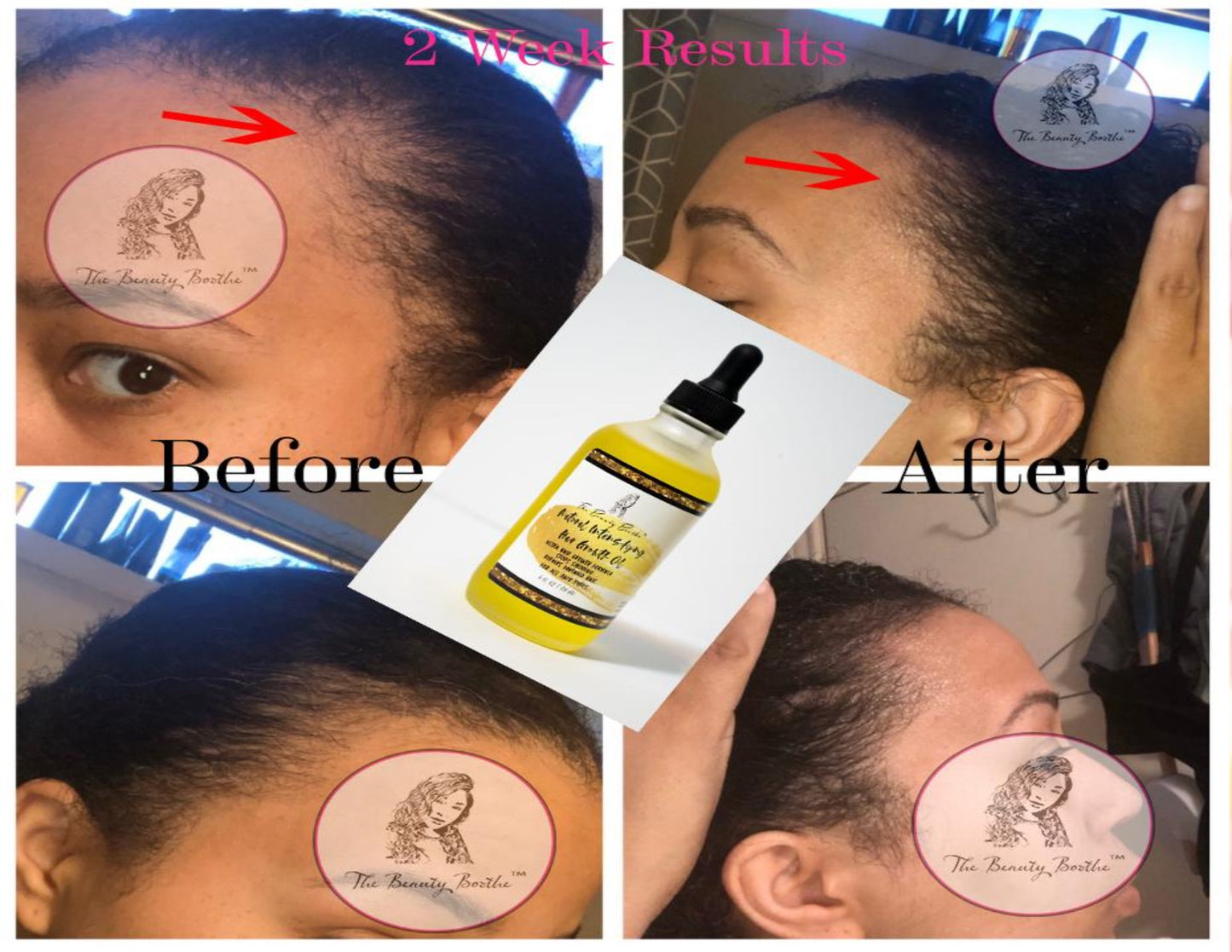 Natural Intensifying Hair Growth Oil